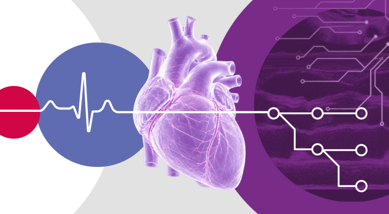 AI may expand diagnostic capabilities in cardiology